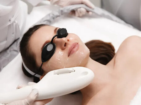 IPL - Photofacial